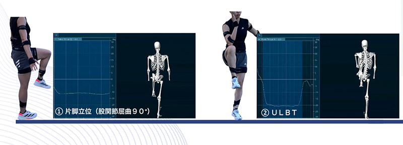 KOJI AWARENESS “upper and lower body, mobility and stability test”を活用した骨盤左右制動性の可視化
