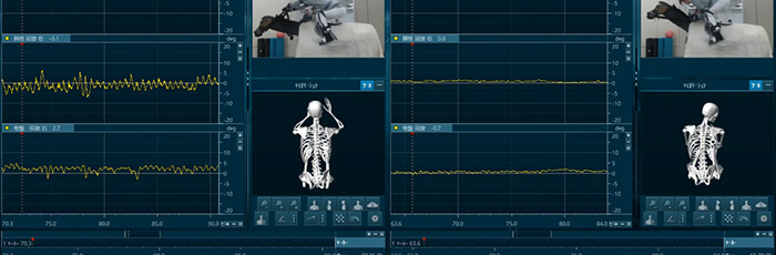 myoMOTION(IMU 14点)+ インソール型足圧センサー